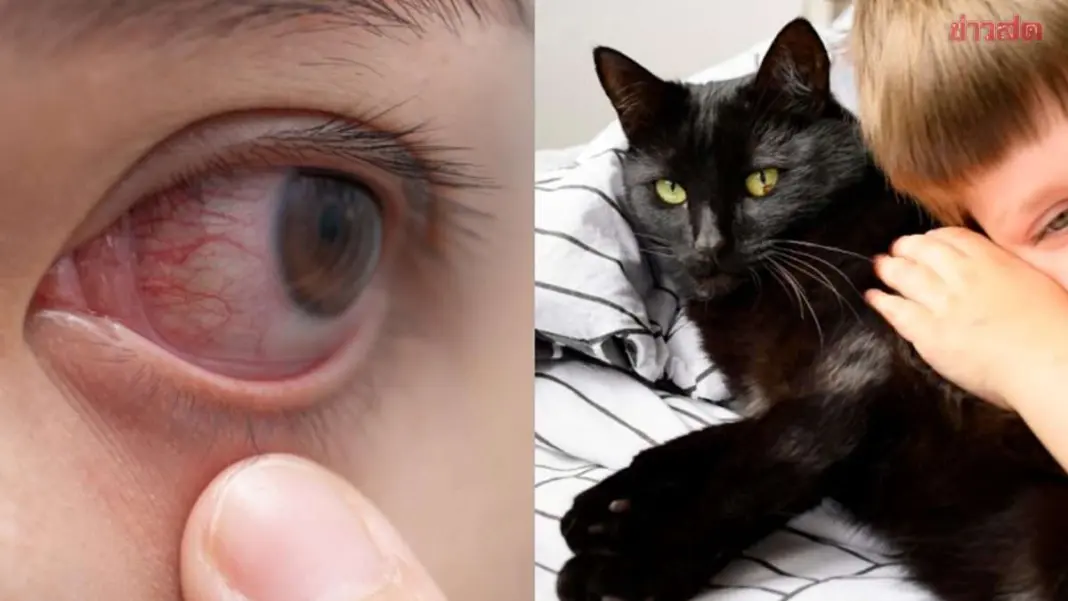 Boy, 11, Nearly Blinded After Playing With Beloved Family Cat Boy, 11, Nearly Blinded After Playing With Beloved Family Cat